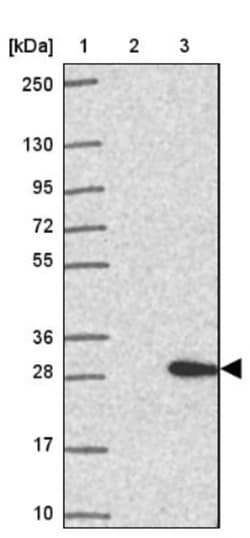 SH2D6 Antibody, Novus Biologicals 25 &mu;L, Unlabeled:Antibodies, Polyclonal